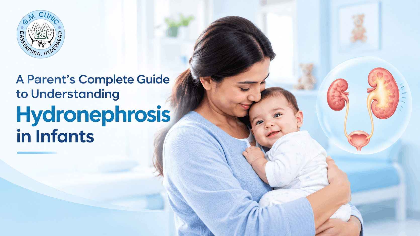 Hydronephrosis in Infants